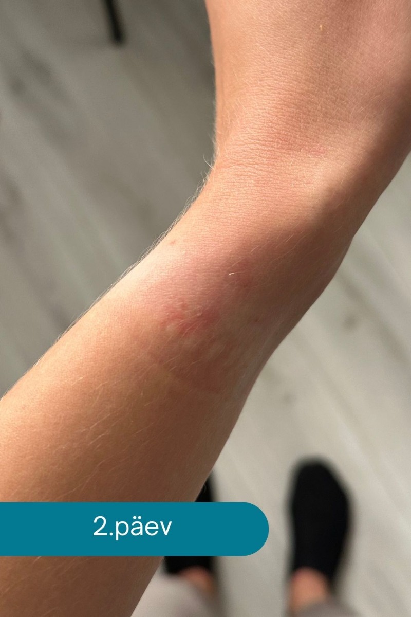 Ovelle Calamine Cream ādas nomierināšanai