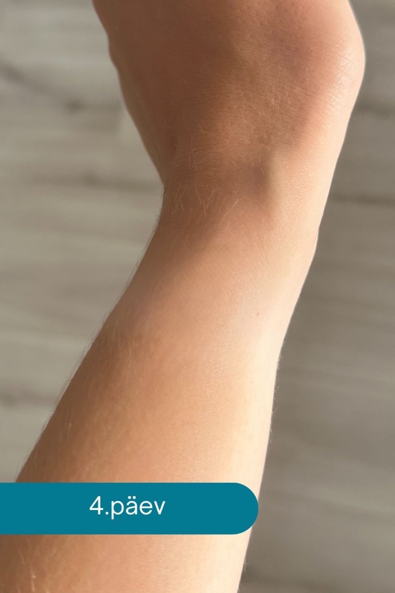 Ovelle Calamine Cream ādas kairinājuma mazināšanai