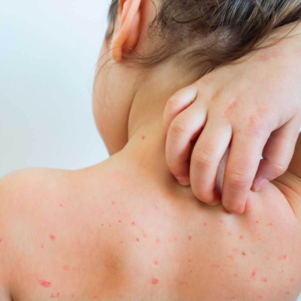 tuuler_ugete_leevendamine