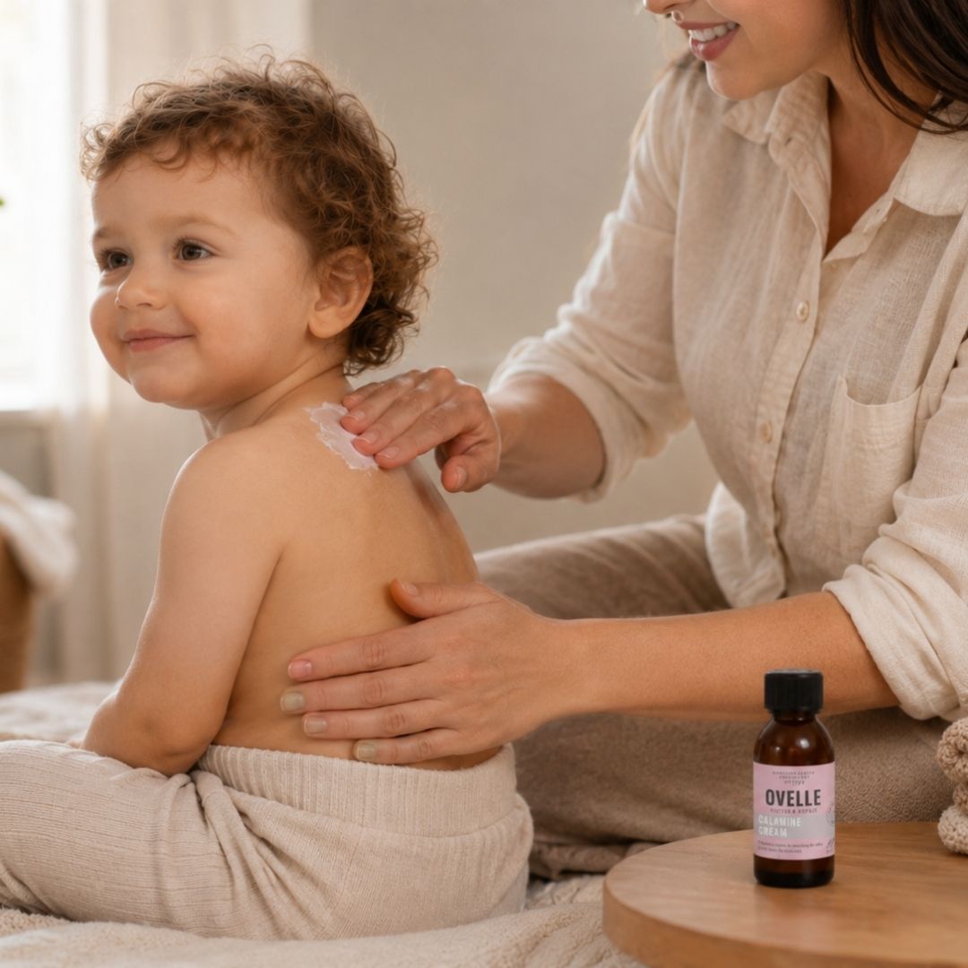 Ovelle Calamine Cream lietošana vējbaku gadījumā uz niezošas ādas